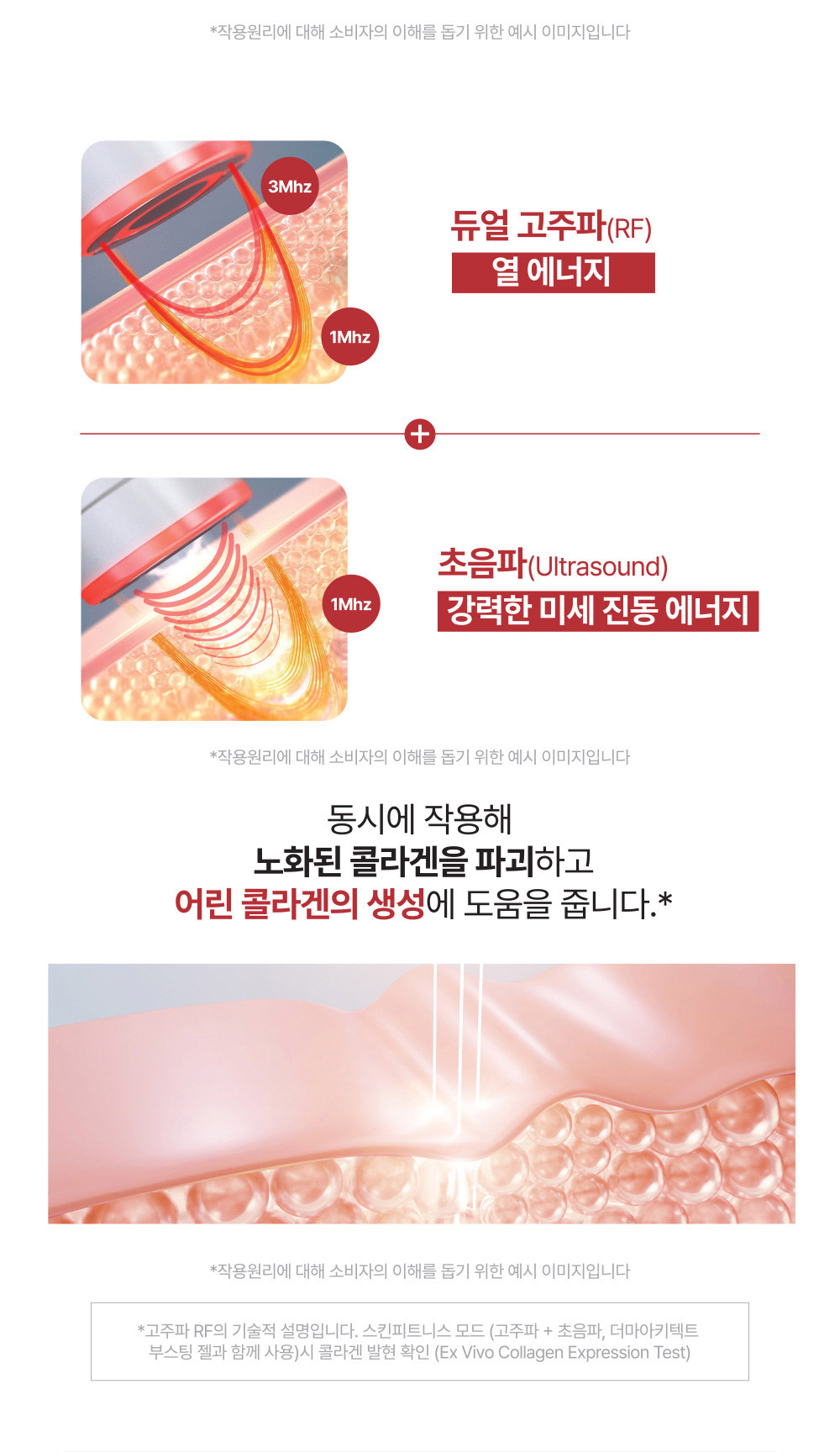 듀얼 고주파(RF) 열 에너지 + 초음파(Ultrasound) 강력한 미세 진동 에너지 동시에 작용해 노화된 콜라겐을 파괴하고 어린 콜라겐의 생성에 도움을 줍니다.