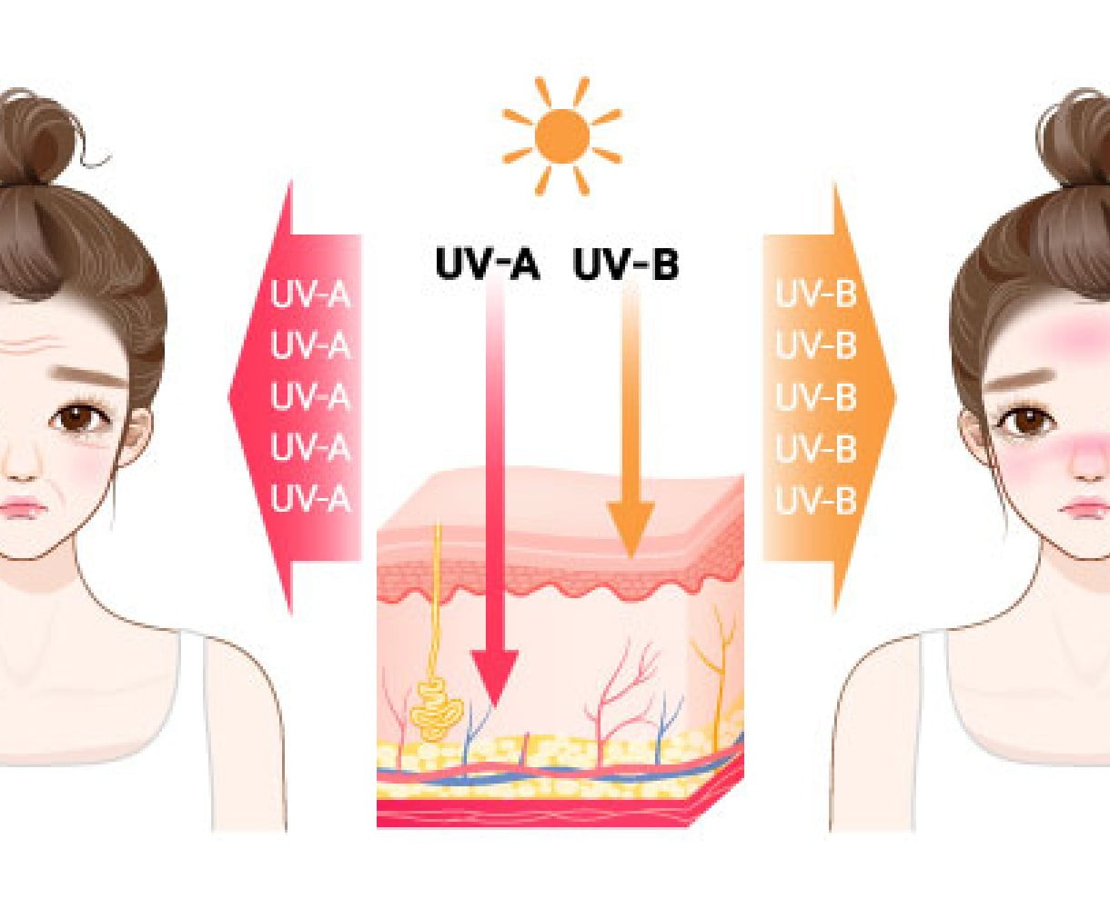 UV-A / UV-B 영향 받은 여자 일러스트
